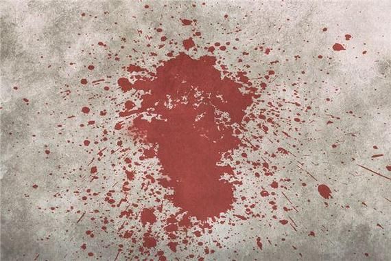 孕妇梦到出血是什么意思_孕妇梦见出血预示什么