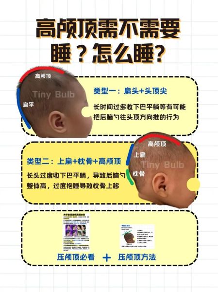 宝宝额头突出高正常吗_宝宝额头突出高图片对比