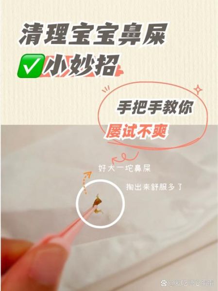 怎么给宝宝掏鼻屎_宝宝鼻屎清理方法