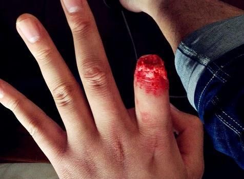 梦见手流血是什么意思_如何化解噩梦带来的焦虑