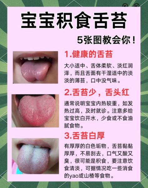 吃母乳的宝宝舌苔发白怎么回事_需要看医生吗