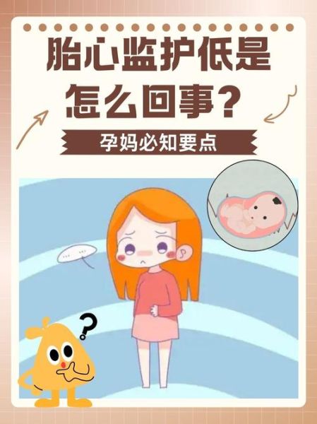 做胎监宝宝不动怎么办_胎监宝宝不动的原因