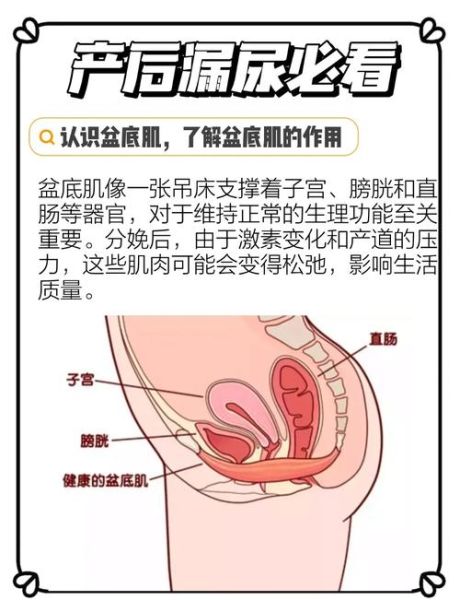 生完宝宝漏尿怎么办_产后漏尿多久能恢复