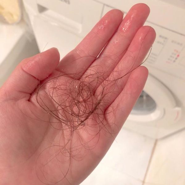 梦到脱发是什么意思_梦见掉头发怎么办