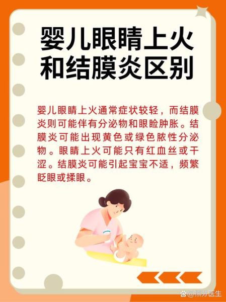 宝宝眼睛发炎怎么办_宝宝眼睛发炎图片怎么看