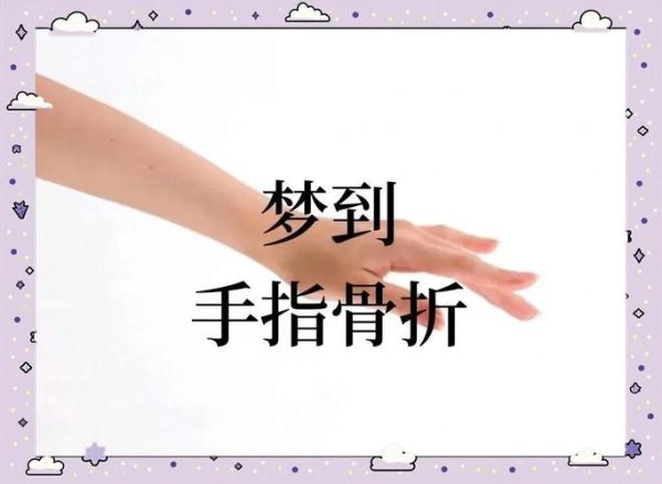 梦见自己骨折是什么意思_骨折梦境预示什么