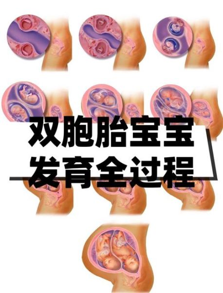 梦到怀双胞胎是什么意思_生双胞胎预示什么