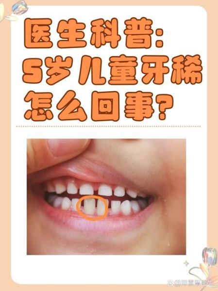 宝宝牙齿缺口怎么回事_宝宝牙齿缺口怎么办