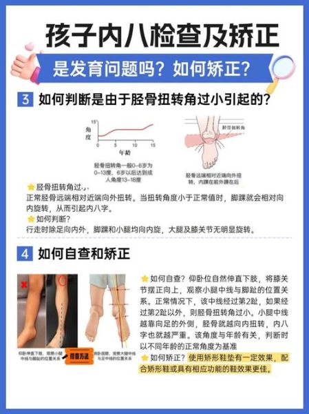 宝宝走路左脚外撇正常吗_如何矫正左脚内八字
