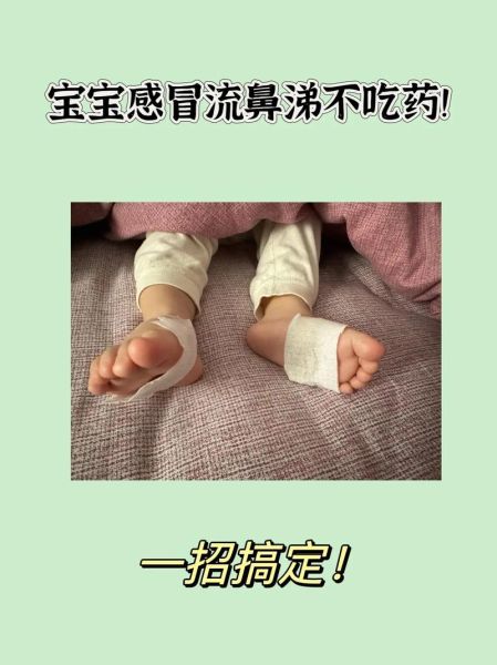 四个月宝宝流鼻涕打喷嚏怎么办_需要吃药吗