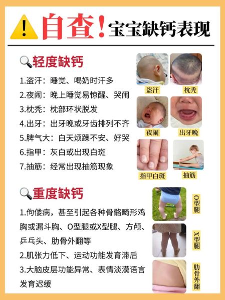 4个月宝宝补钙吃什么_缺钙表现有哪些