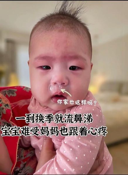 三岁宝宝流鼻涕一个月了怎么办_反复流鼻涕的原因