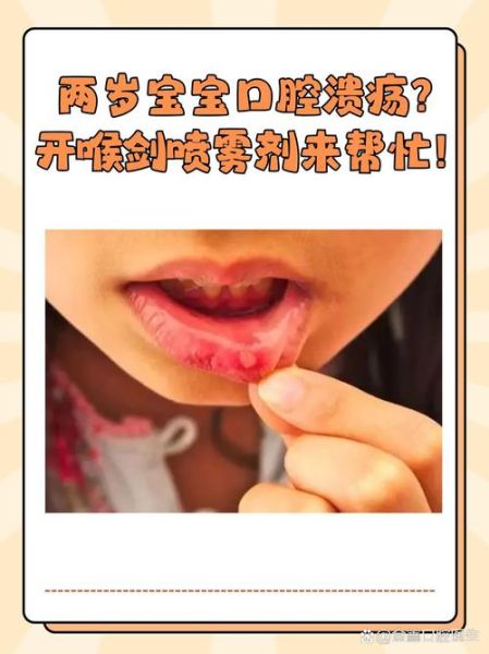 宝宝嘴唇溃疡怎么办_宝宝口腔溃疡吃什么好