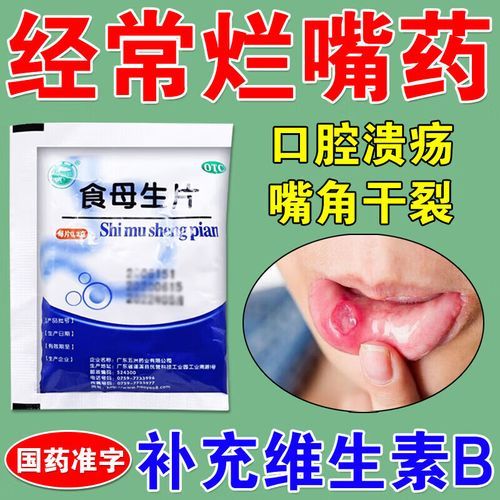 宝宝嘴唇溃疡怎么办_宝宝口腔溃疡吃什么好