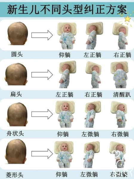 宝宝睡姿会影响头型吗_新生儿仰睡侧睡怎么选