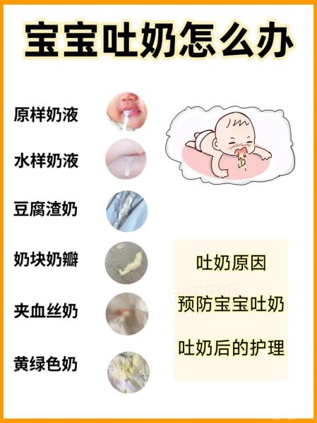 宝宝吐奶很严重怎么办_新生儿吐奶频繁如何缓解