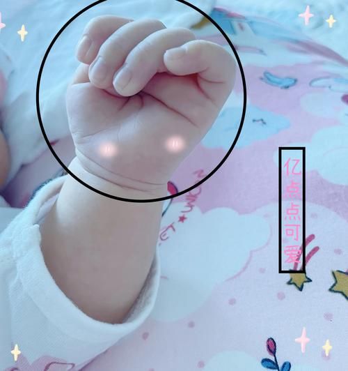 宝宝大拇指内扣是什么原因_需要干预吗