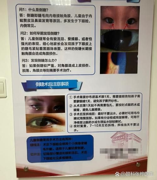 宝宝倒睫毛怎么处理_婴儿倒睫会自愈吗