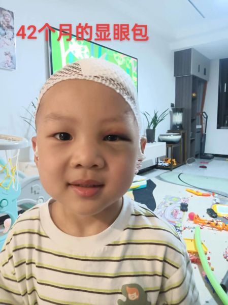 新生儿眼睛肿了怎么办_宝宝眼睛肿多久能消