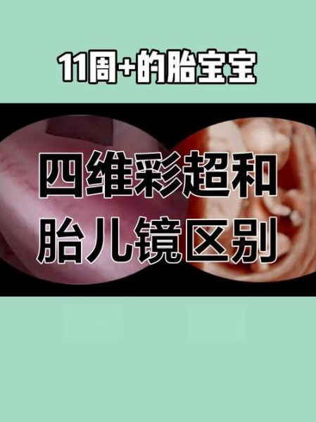 11周胎儿大小_怀孕11周宝宝发育图怎么看