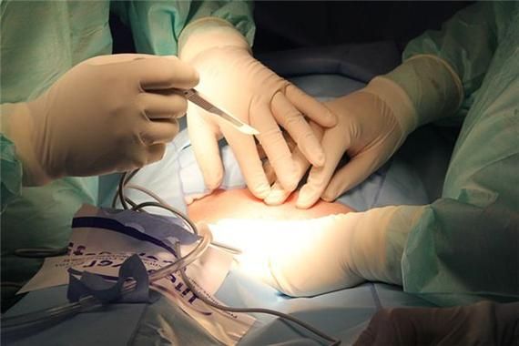 梦到手术是什么意思_梦见自己开刀预示什么