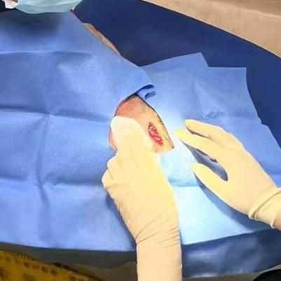 梦到手术是什么意思_梦见自己开刀预示什么