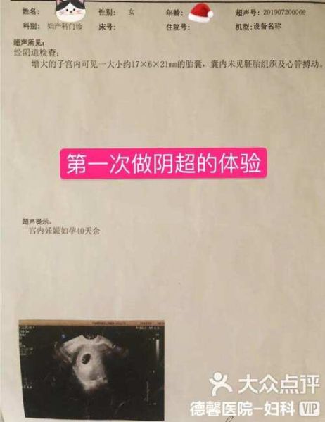 怀孕初期做阴超对宝宝有影响吗_孕早期阴超安全吗