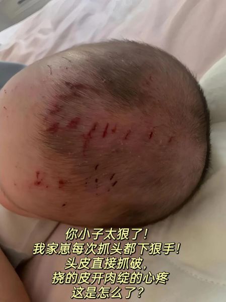 宝宝一直抓头怎么回事_宝宝频繁抓头怎么办