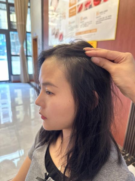 梦到发际线后移是什么意思_梦见头发变少怎么办