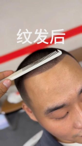 梦到发际线后移是什么意思_梦见头发变少怎么办