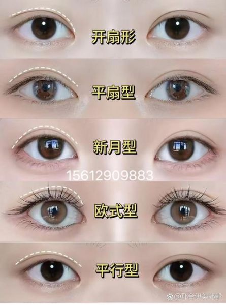 双眼皮图片大全_双眼皮类型有哪些