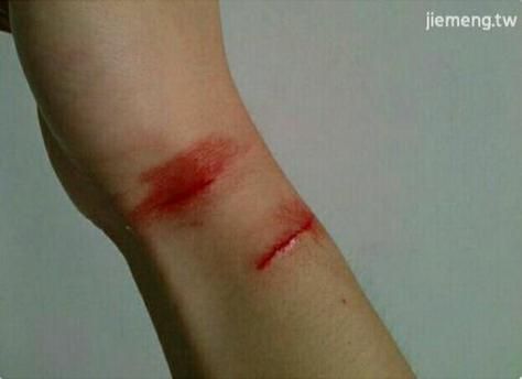 梦到自己受伤流血_是什么意思