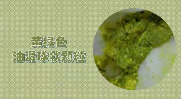 八个月宝宝拉绿色大便怎么回事_正常还是生病