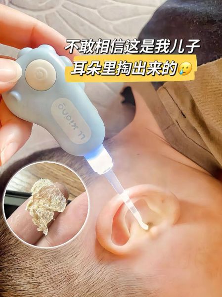 宝宝耳朵有异味怎么办_宝宝耳道清洁正确方法