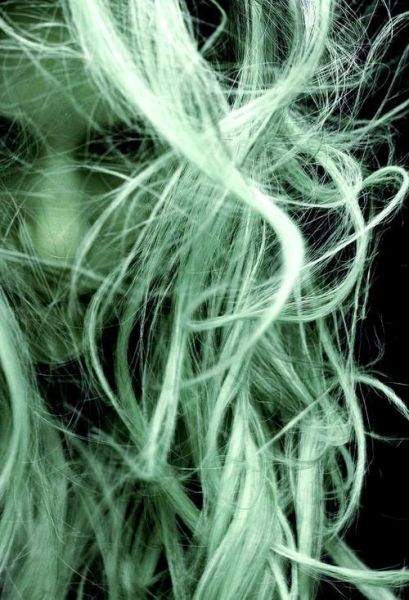 梦到头上长虱子是什么意思_头上长虱子梦境解析