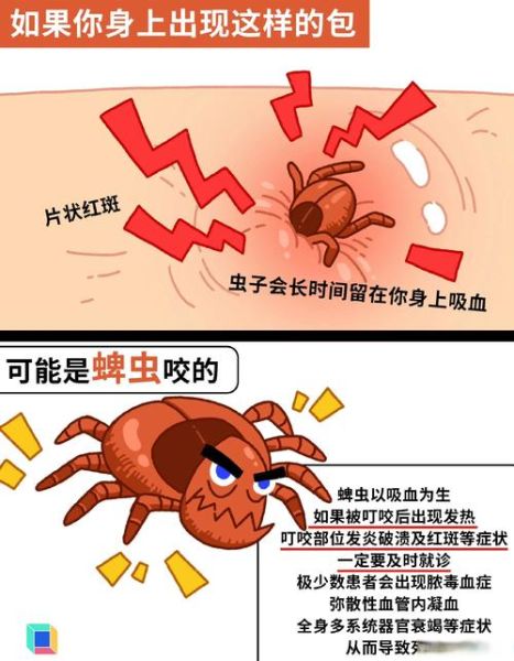 梦到虫子咬是什么预兆_梦见虫子咬自己怎么办