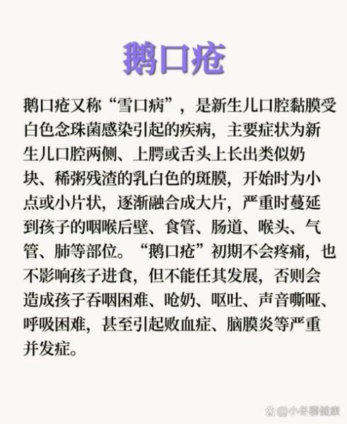 宝宝鹅口疮怎么治_鹅口疮反复怎么办