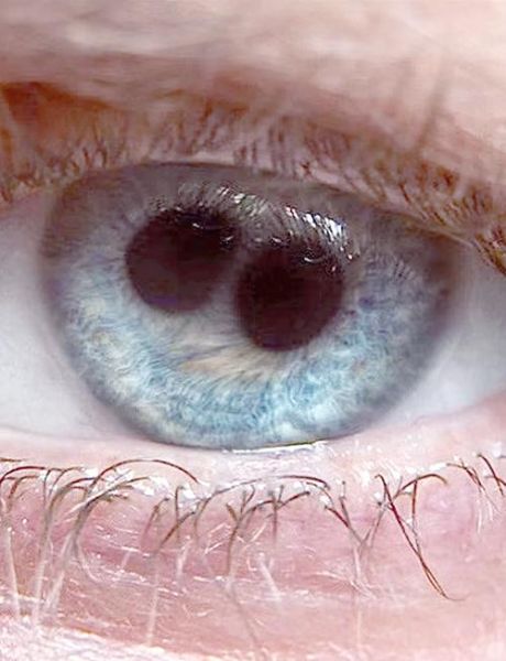 双瞳迅雷下载_双瞳迅雷下载安全吗