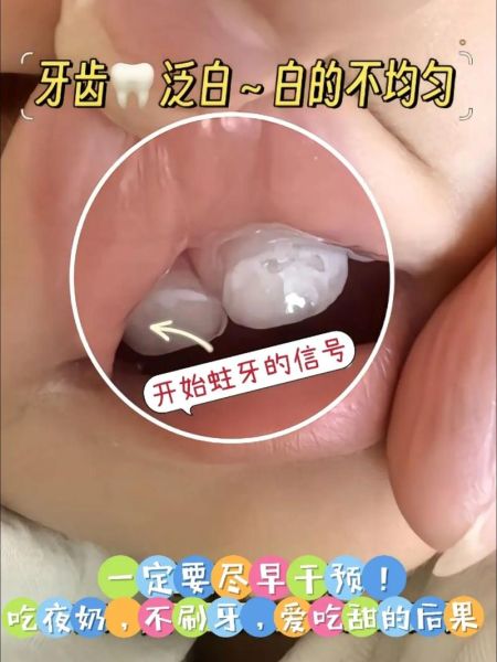 宝宝多大开始刷牙_婴儿第一颗牙怎么清洁