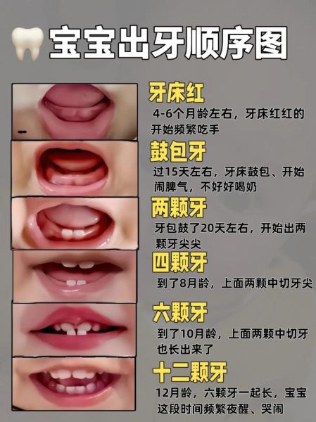 宝宝出牙晚是什么原因_几个月算正常