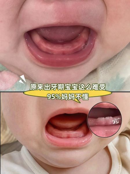 1岁宝宝白天咬牙咯咯响_是不是缺微量元素