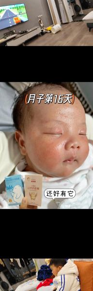 宝宝脸上红斑怎么回事_新生儿红斑多久能好