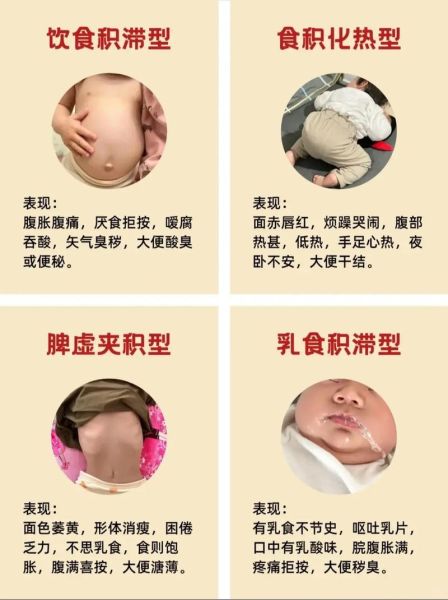 八个月宝宝积食症状_怎么判断