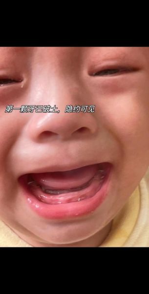 7个月宝宝长牙症状_宝宝长牙哭闹怎么办