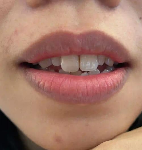 宝宝唇线颜色深_宝宝唇线发黑怎么回事