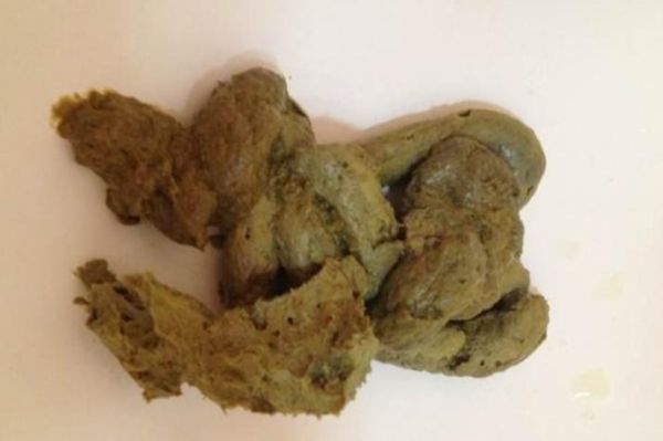 粑粑图片大全_正常大便长什么样