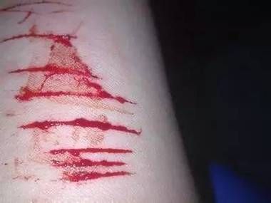 梦到自残是什么意思_如何缓解梦中自残焦虑