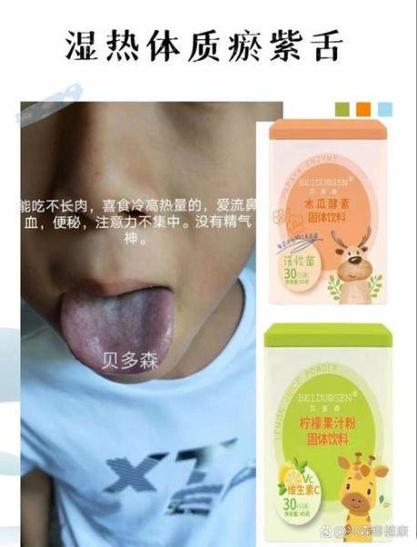 宝宝舌头发紫是怎么回事_需要立即就医吗