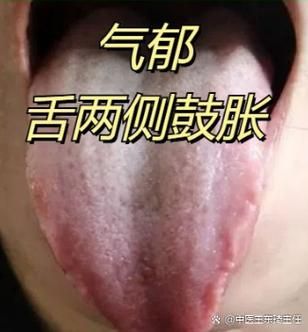 宝宝舌头发紫是怎么回事_需要立即就医吗