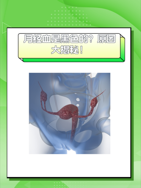 梦见来月经是什么意思_梦见月经血好不好